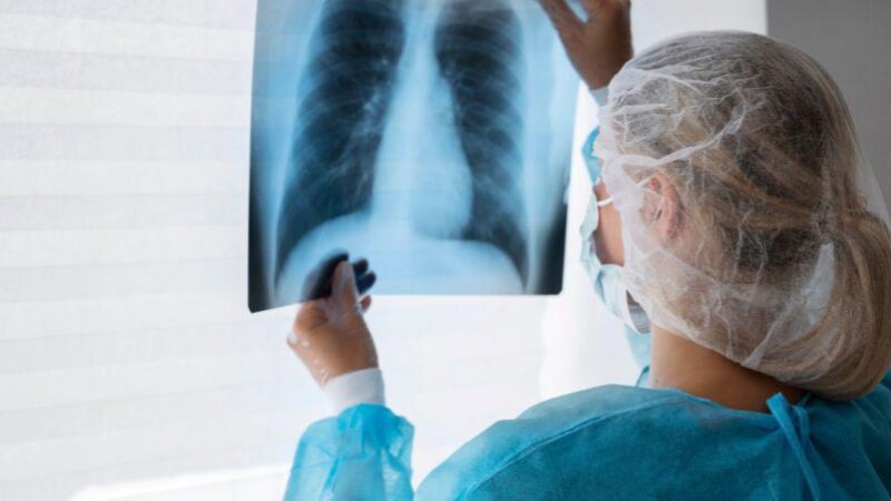 Capacitação profissional foca na detecção rápida da tuberculose