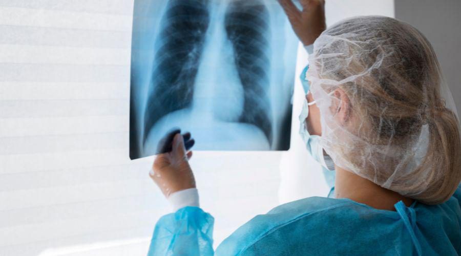 Capacitação profissional foca na detecção rápida da tuberculose